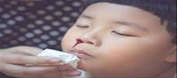 Attention parents..! Children's nose bleeding? Don't ignore it..!
